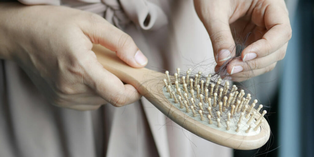 Hair loss in a hair brush held by a womans hand